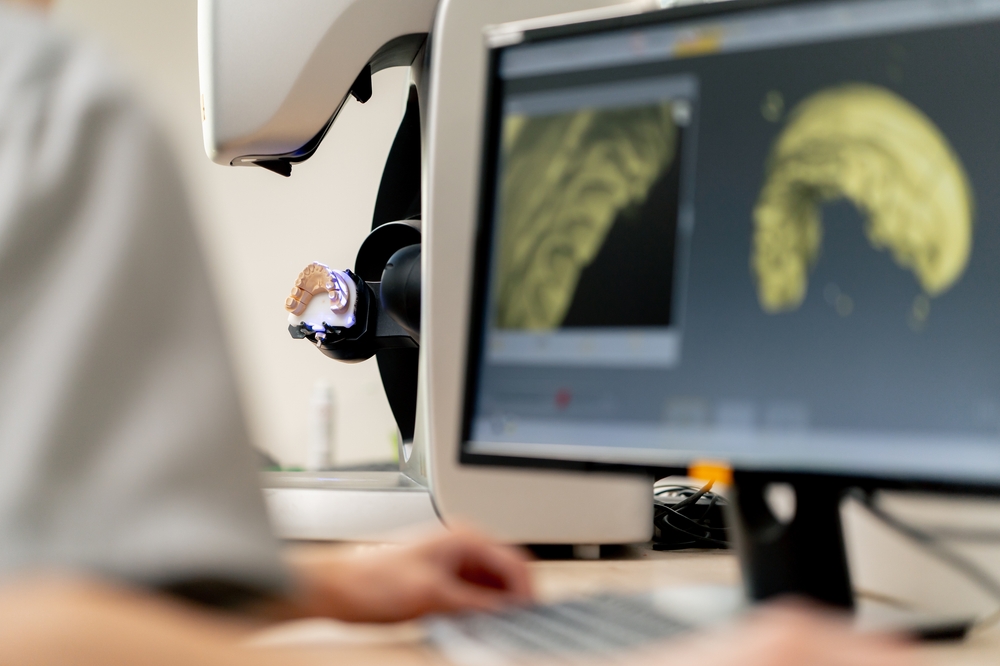 Intra-oral scan being processed on screen