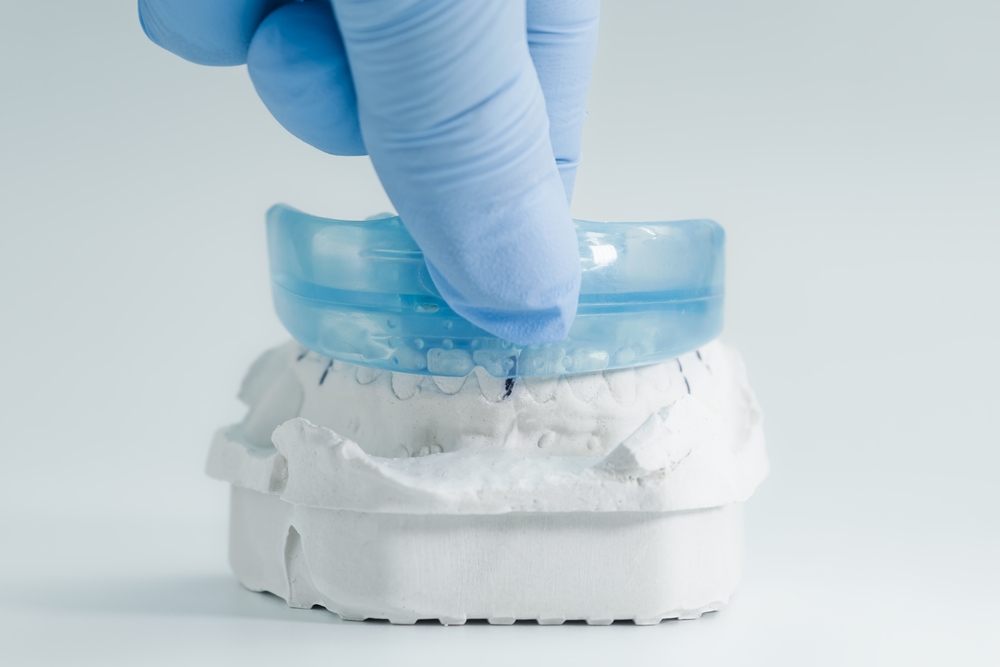 Thermoformed blue dental appliance seated on a plaster model